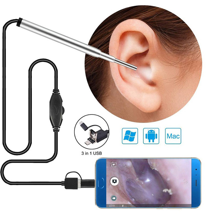 Medikal nga Endoscope Camera Dalunggan sa Ilong Endoscope Usb Otoscope